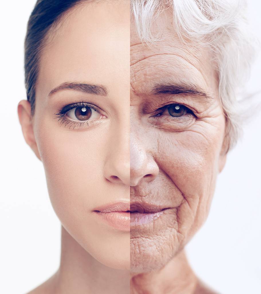 before-after